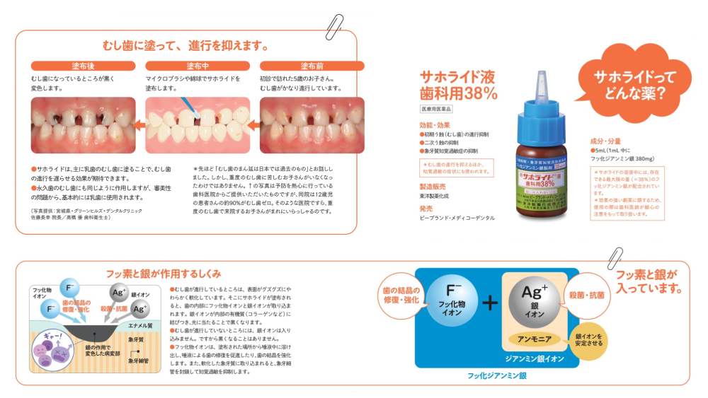 虫歯治療がどうしてもできない場合