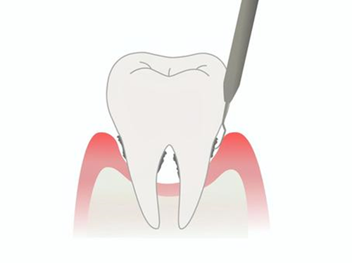 最初より、状況が改善しているか確認します。
再度検査をします。