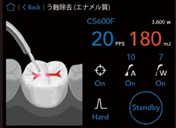 歯を削る音（キュイーンといった独特の音）が苦手な方へ